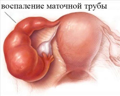 Колокольные звоны которые лечат