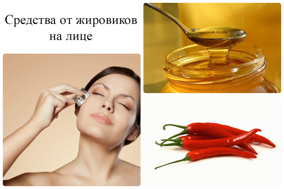 как избавиться от паразитов день как избавиться от паразитов день